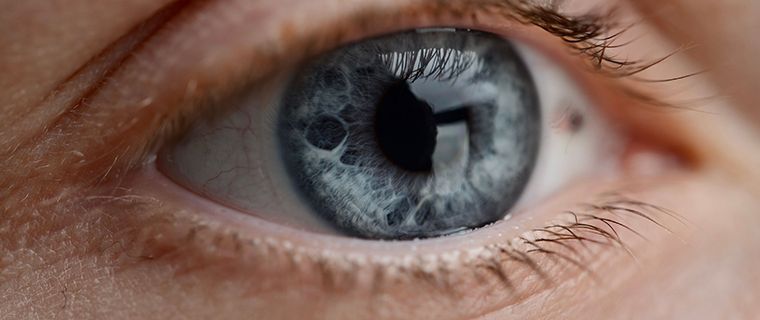 Cómo saber si un nevus ocular es maligno